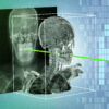 New AI technique could make minimally invasive surgeries safer and more precise | MIT News