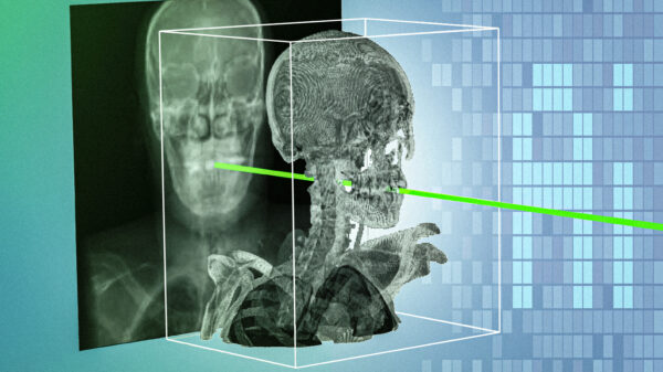 New AI technique could make minimally invasive surgeries safer and more precise | MIT News